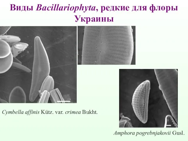 Виды Bacillariophyta, редкие для флоры Украины Amphora pogrebnjakovii Gusl. Cymbella affinis Kütz. var. crimea Bukht.