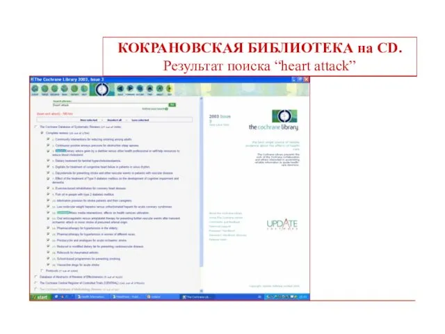 КОКРАНОВСКАЯ БИБЛИОТЕКА на CD. Результат поиска “heart attack”
