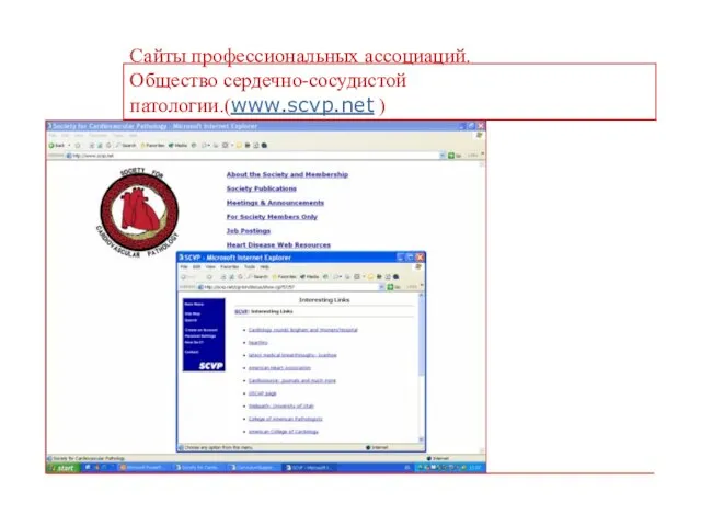 Сайты профессиональных ассоциаций. Общество сердечно-сосудистой патологии.(www.scvp.net )