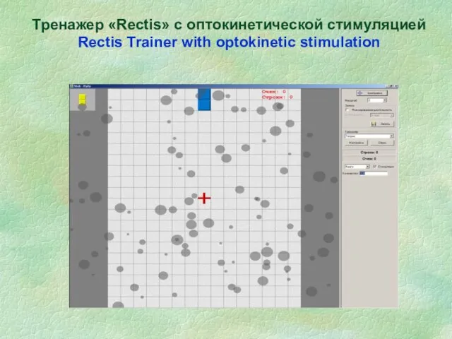 Тренажер «Rectis» с оптокинетической стимуляцией Rectis Trainer with optokinetic stimulation