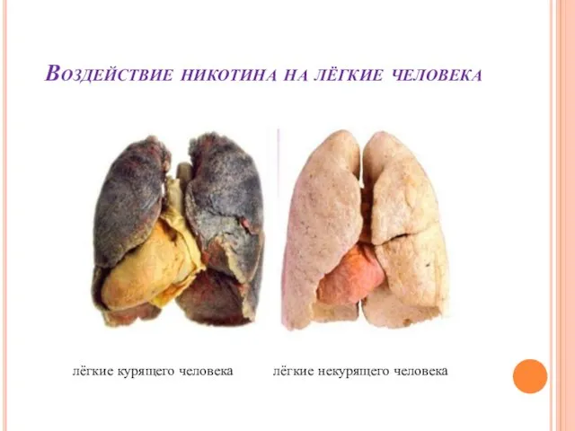 Воздействие никотина на лёгкие человека лёгкие курящего человека лёгкие некурящего человека