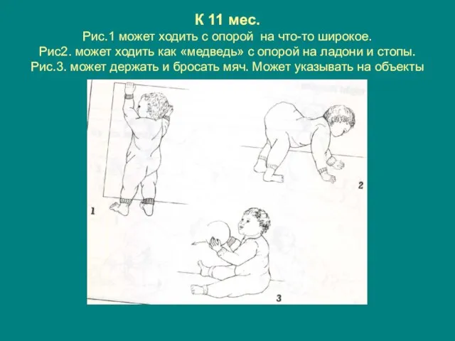 К 11 мес. Рис.1 может ходить с опорой на что-то широкое. Рис2.