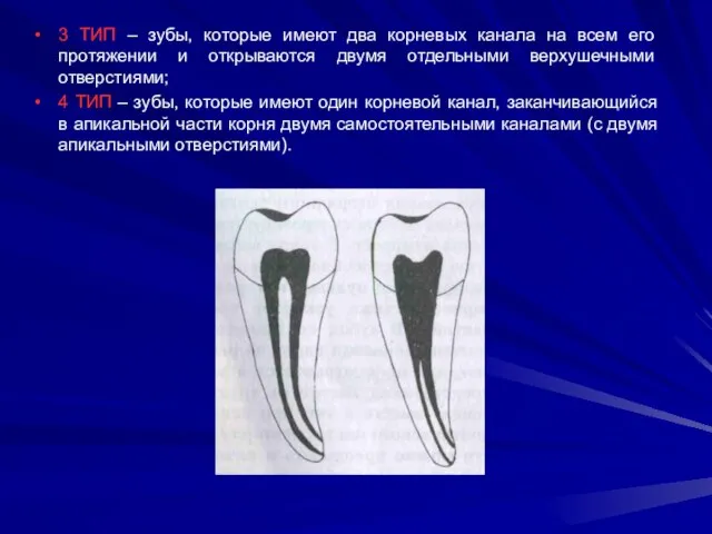 3 ТИП – зубы, которые имеют два корневых канала на всем его