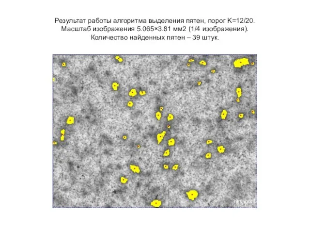 Результат работы алгоритма выделения пятен, порог K=12/20. Масштаб изображения 5.065×3.81 мм2 (1/4