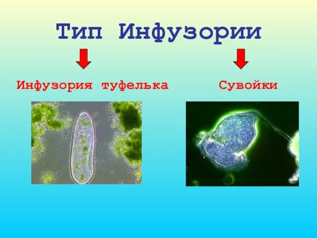 Тип Инфузории Сувойки Инфузория туфелька