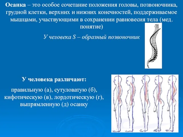 Осанка – это особое сочетание положения головы, позвоночника, грудной клетки, верхних и