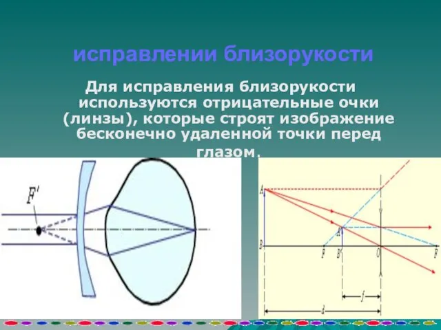 исправлении близорукости Для исправления близорукости используются отрицательные очки (линзы), которые строят изображение