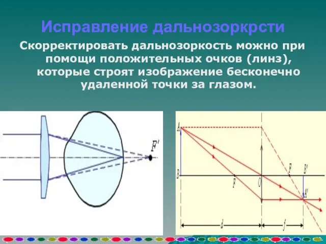 Исправление дальнозоркрсти Скорректировать дальнозоркость можно при помощи положительных очков (линз), которые строят