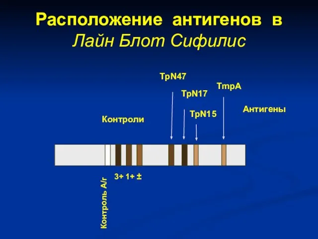 Расположение антигенов в Лайн Блот Сифилис Контроли Антигены TpN47 TpN17 TpN15 TmpA