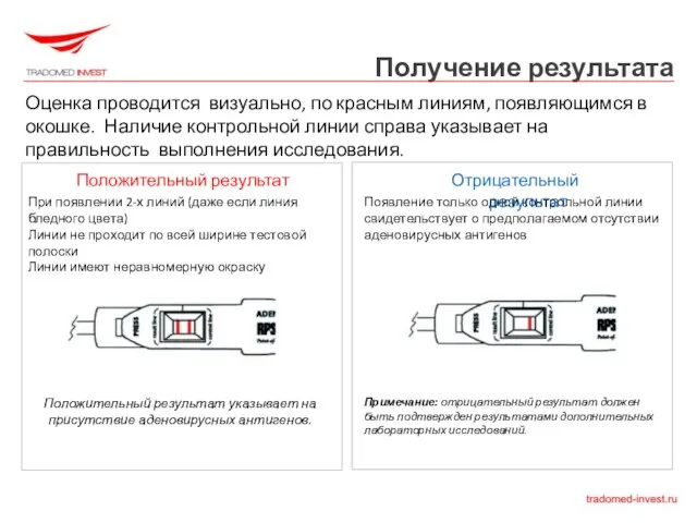 Получение результата Оценка проводится визуально, по красным линиям, появляющимся в окошке. Наличие