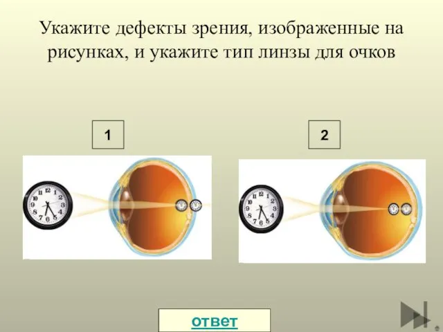 Укажите дефекты зрения, изображенные на рисунках, и укажите тип линзы для очков 1 2 ответ