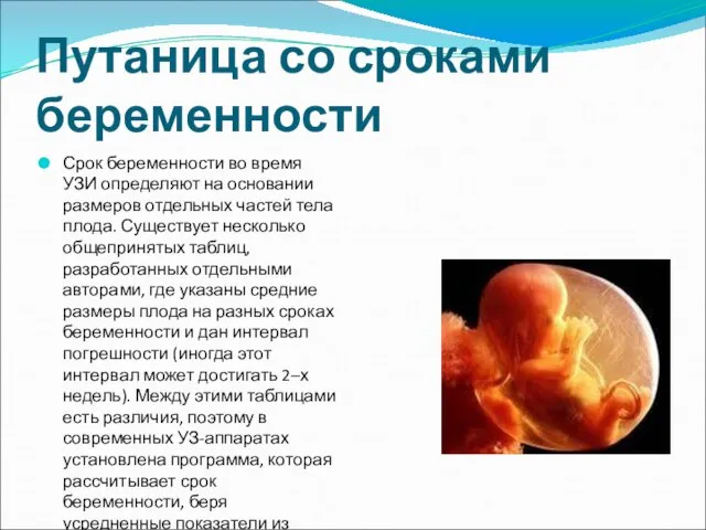 Путаница со сроками беременности Срок беременности во время УЗИ определяют на основании