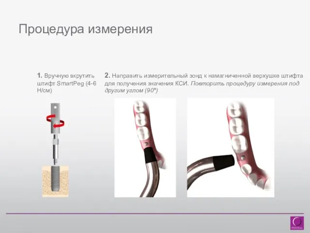 Процедура измерения 1. Вручную вкрутить штифт SmartPeg (4-6 Н/см) 2. Направить измерительный