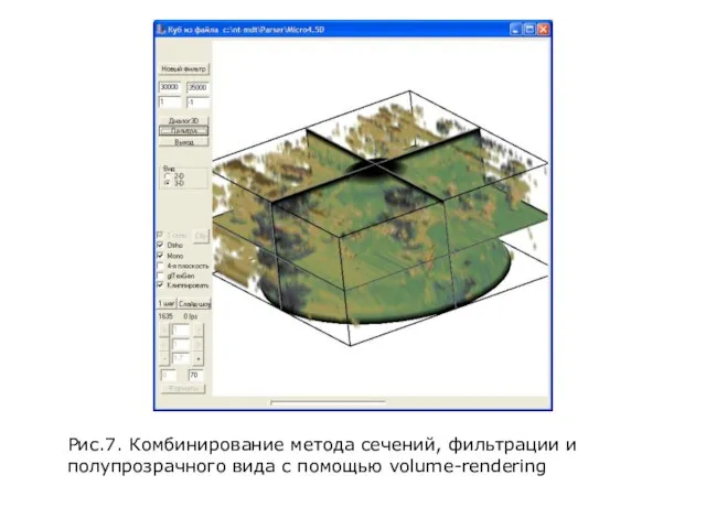 Рис.7. Комбинирование метода сечений, фильтрации и полупрозрачного вида с помощью volume-rendering