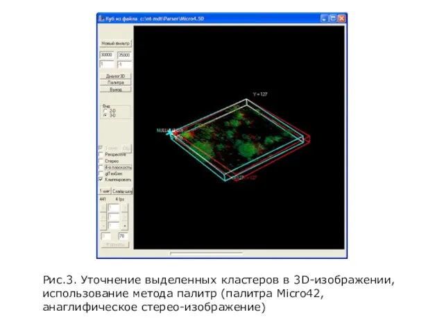 Рис.3. Уточнение выделенных кластеров в 3D-изображении, использование метода палитр (палитра Micro42, анаглифическое стерео-изображение)