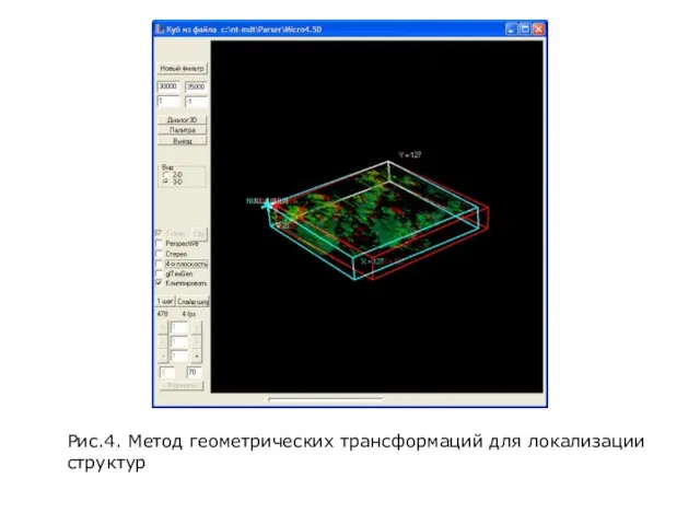 Рис.4. Метод геометрических трансформаций для локализации структур