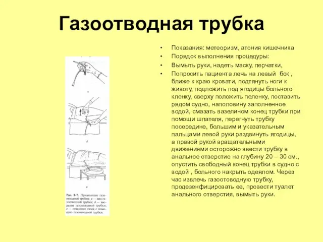 Газоотводная трубка Показания: метеоризм, атония кишечника Порядок выполнения процедуры: Вымыть руки, надеть