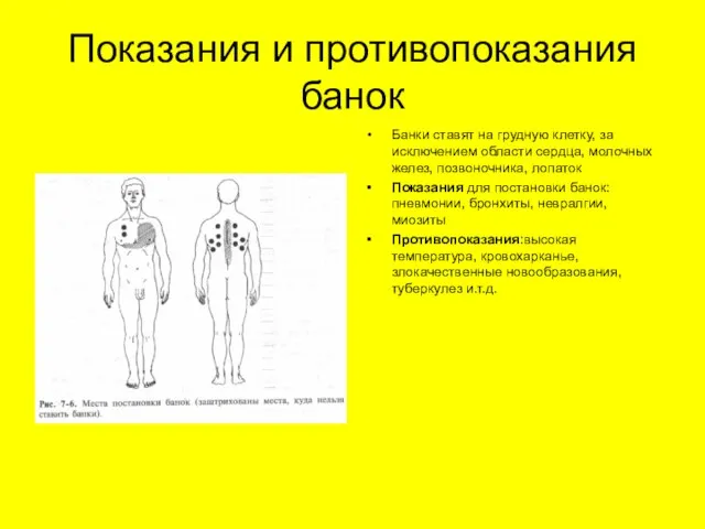 Показания и противопоказания банок Банки ставят на грудную клетку, за исключением области