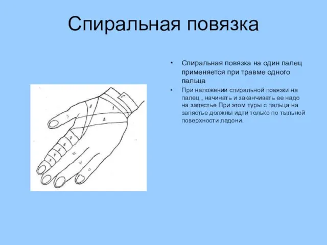 Спиральная повязка Спиральная повязка на один палец применяется при травме одного пальца