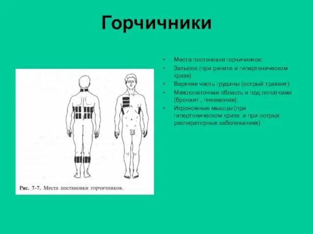 Горчичники Места постановки горчичников: Затылок (при рините и гипертоническом кризе) Верхняя часть