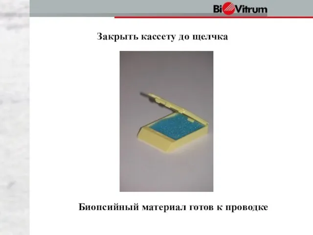 Закрыть кассету до щелчка Биопсийный материал готов к проводке