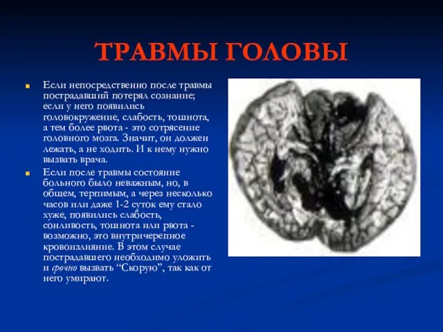 ТРАВМЫ ГОЛОВЫ Если непосредственно после травмы пострадавший потерял сознание; если у него