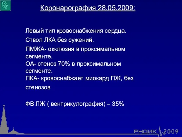 Коронарография 28.05.2009: Левый тип кровоснабжения сердца. Ствол ЛКА без сужений. ПМЖА- окклюзия