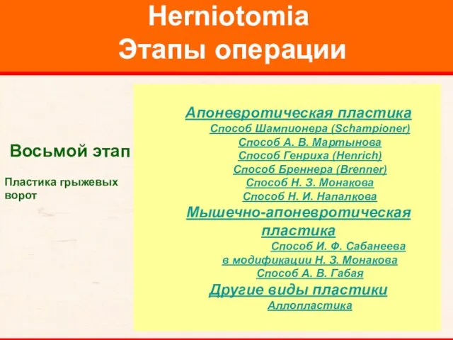 Herniotomia Этапы операции Восьмой этап Пластика грыжевых ворот Апоневротическая пластика Способ Шампионера