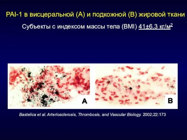 PAI-1 в висцеральной (A) и подкожной (B) жировой ткани Субъекты с индексом