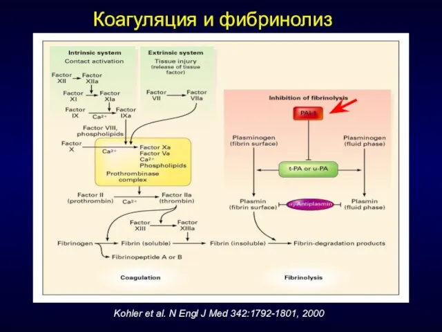 Коагуляция и фибринолиз Kohler et al. N Engl J Med 342:1792-1801, 2000