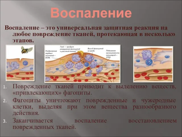 Воспаление Воспаление – это универсальная защитная реакция на любое повреждение тканей, протекающая