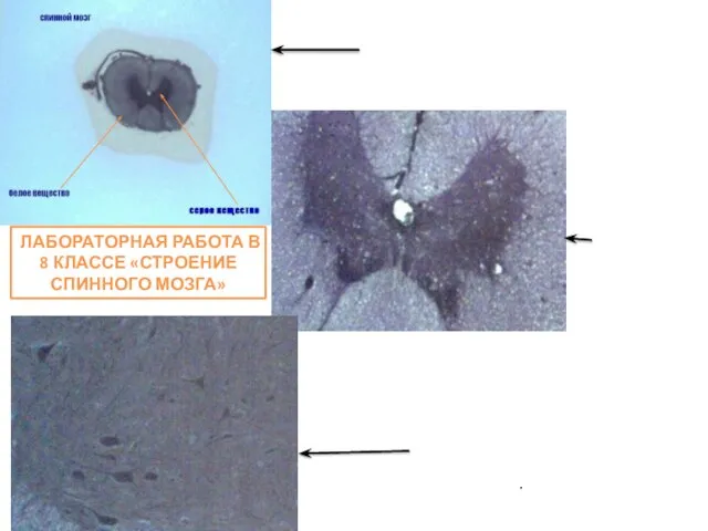 ЛАБОРАТОРНАЯ РАБОТА В 8 КЛАССЕ «СТРОЕНИЕ СПИННОГО МОЗГА» ГОТОВЫЙ ПРЕПАРАТ СПИННОГО МОЗГА.