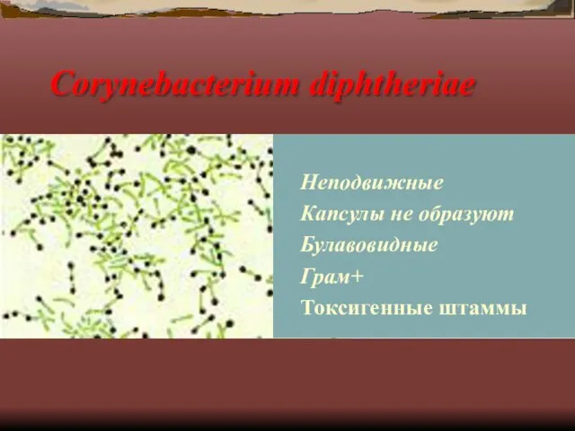 Corynebacterium diphtheriae Неподвижные Капсулы не образуют Булавовидные Грам+ Токсигенные штаммы