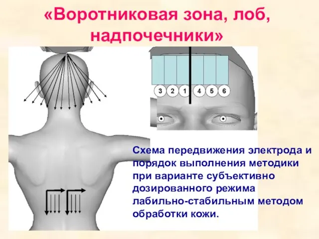 «Воротниковая зона, лоб, надпочечники» Схема передвижения электрода и порядок выполнения методики при