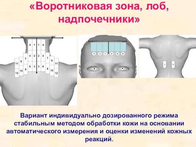 «Воротниковая зона, лоб, надпочечники» Вариант индивидуально дозированного режима стабильным методом обработки кожи