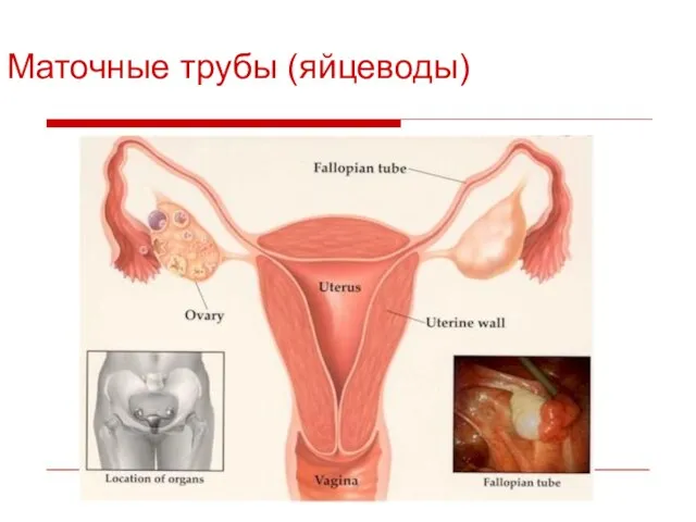 Маточные трубы (яйцеводы)