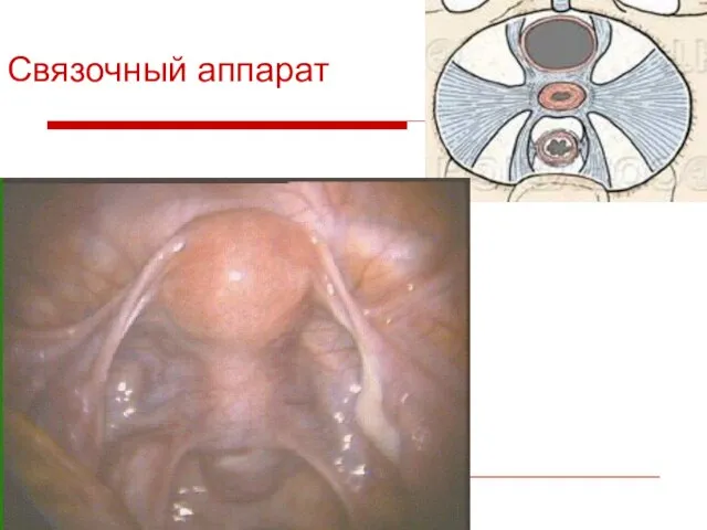 Связочный аппарат