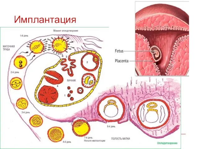 Имплантация