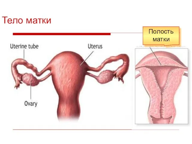Тело матки Полость матки