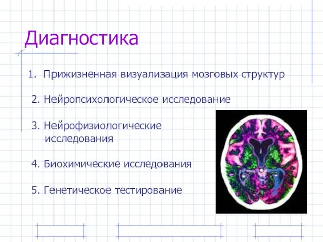 Диагностика Прижизненная визуализация мозговых структур 2. Нейропсихологическое исследование 3. Нейрофизиологические исследования 4.