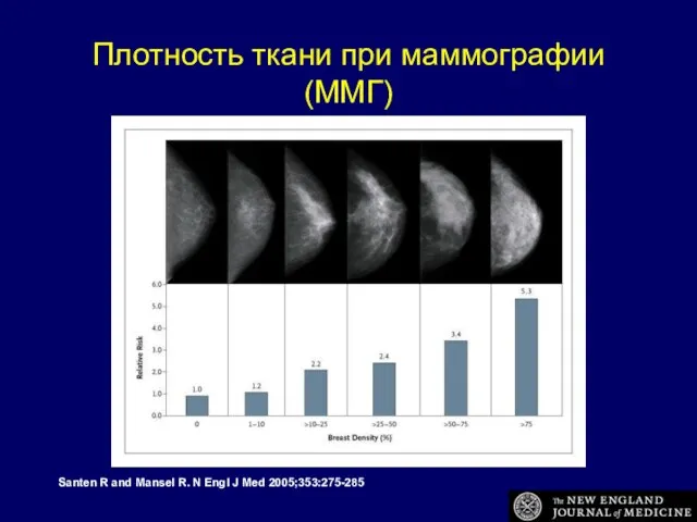 Плотность ткани при маммографии (ММГ) Santen R and Mansel R. N Engl J Med 2005;353:275-285