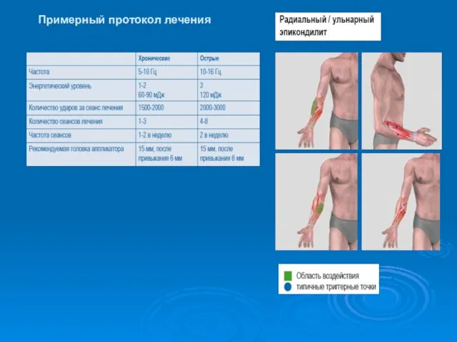 Примерный протокол лечения