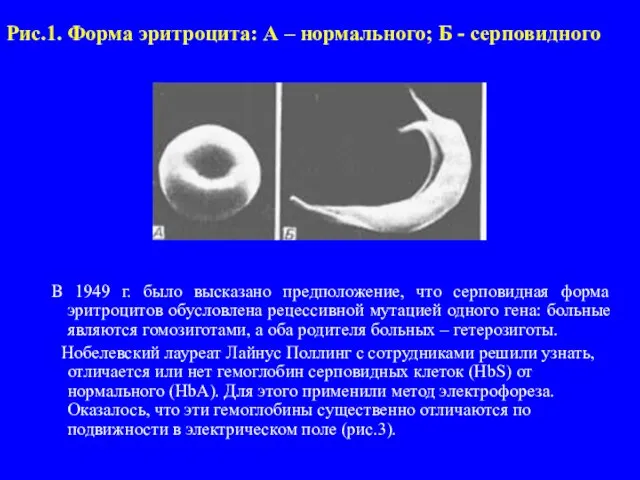 Рис.1. Форма эритроцита: А – нормального; Б - серповидного В 1949 г.