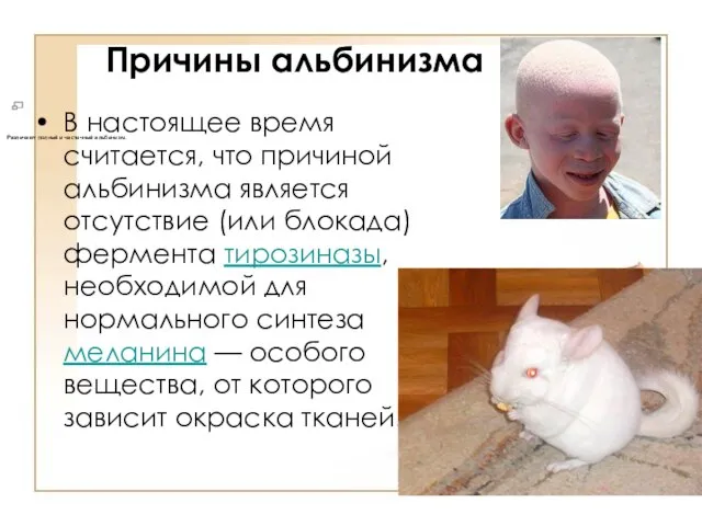 Альбинизм (лат. albus - белый) — врождённое отсутствие пигмента кожи, волос, радужной