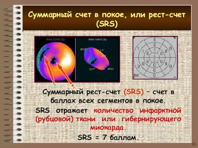 Суммарный счет в покое, или рест-счет (SRS) Суммарный рест-счет (SRS) – счет