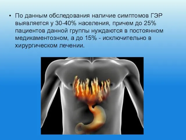 По данным обследования наличие симптомов ГЭР выявляется у 30-40% населения, причем до