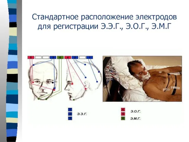 Стандартное расположение электродов для регистрации Э.Э.Г., Э.О.Г., Э.М.Г