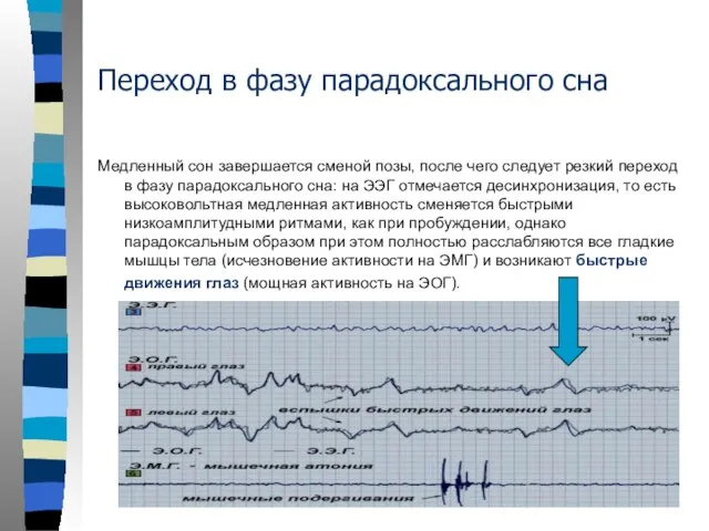 Переход в фазу парадоксального сна Медленный сон завершается сменой позы, после чего