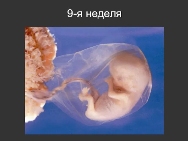 9-я неделя