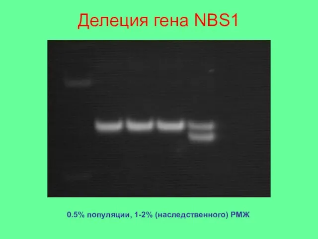 Делеция гена NBS1 0.5% популяции, 1-2% (наследственного) РМЖ